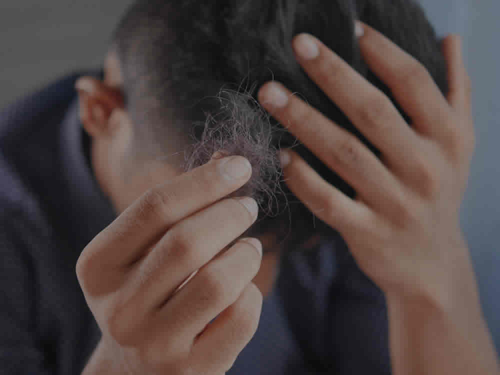 Diagnosis, Advice & Treatment for Men's Hair Loss in Bolton