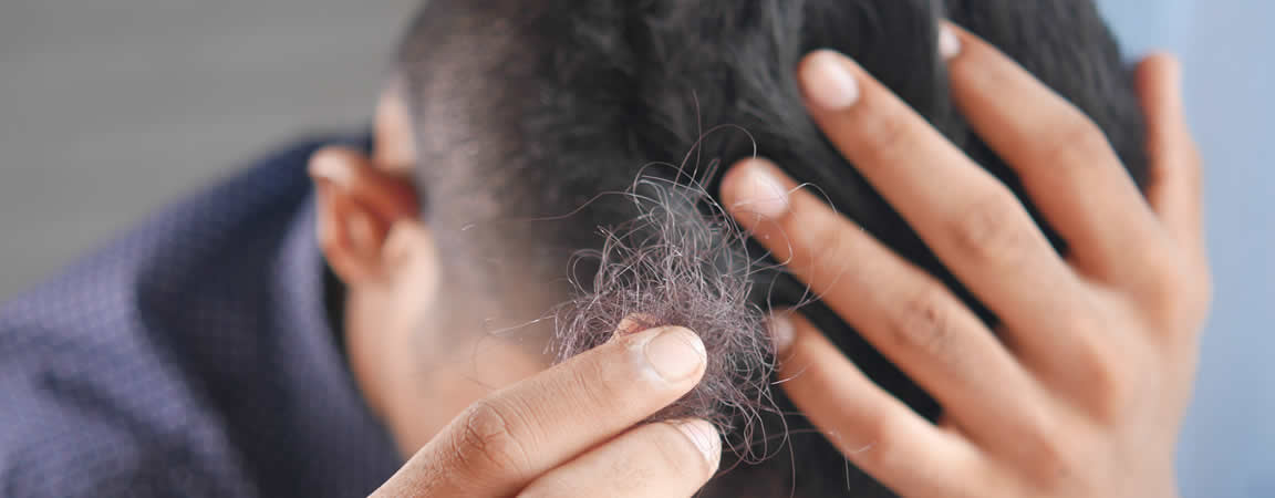 male hair loss treatment Bolton